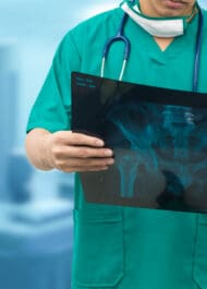 Surgeon holding X-ray image, medical malpractice or personal injury concept