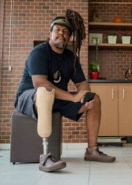 Atlanta Amputation Lawyers - Montlick Injury Attorneys
