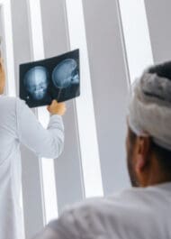 Doctor analyzing x-ray images of patient's skull, assessing head trauma for medical malpractice case